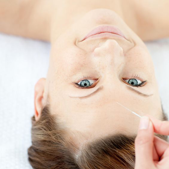 Facial Acupuncture in Ladera Ranch, California